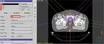 Radiation Oncology Webinars