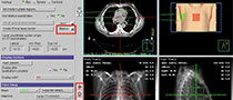 Radiation Oncology Webinars